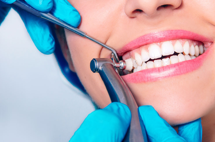 Professional teeth cleaning